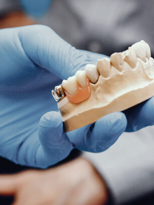 How Does a Dentist Remove a Permanent Bridge