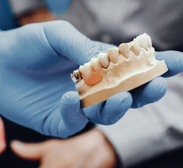 How Does a Dentist Remove a Permanent Bridge? A Step-by-Step Guide
