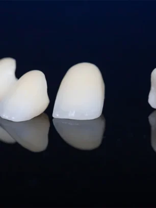 Are Dental Crowns Right for Kids? What Parents Need to Know