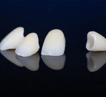 Are Dental Crowns Right for Kids? What Parents Need to Know